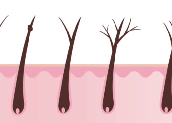 Keine Haarspaltereien!